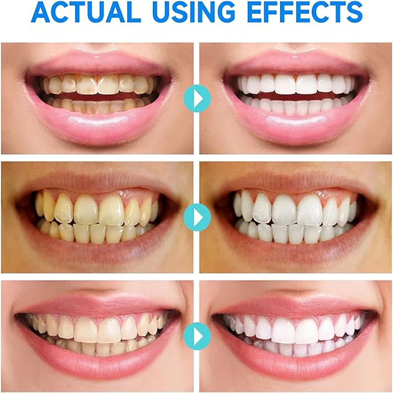 Whitening Toothpaste